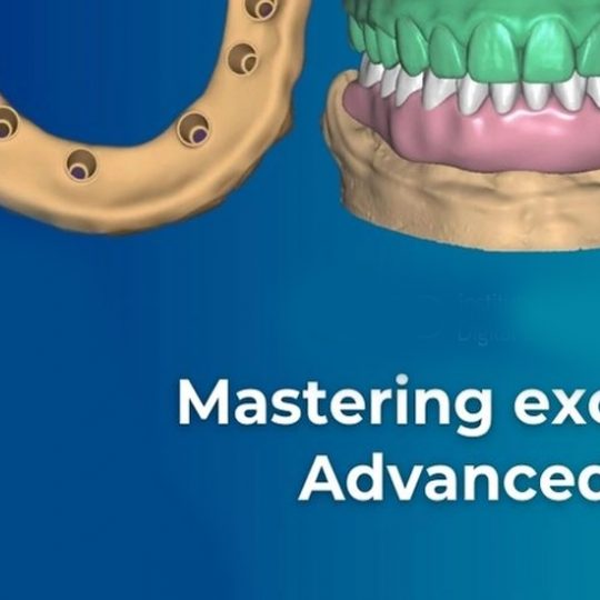 دوره صفر تا صد اگزوکد مقدماتی تا پیشرفته (اگزوکد مستر و پلاتینیوم) Exocad Master