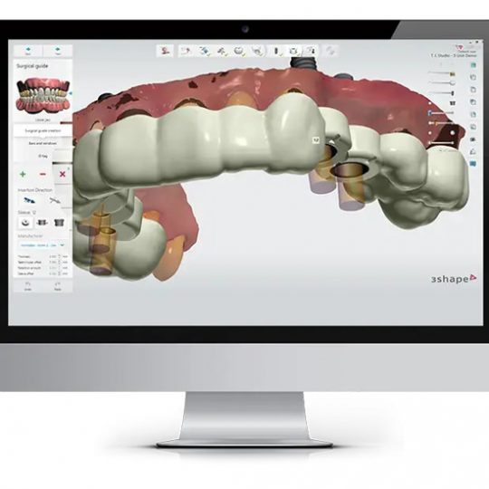 دوره راهنمای جراحی با نرم‌افزار 3Shape